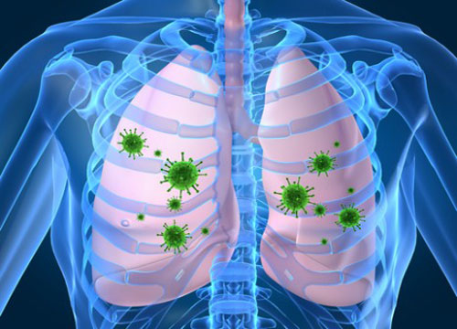 Infections Disease of Lung